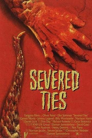 Severed Ties